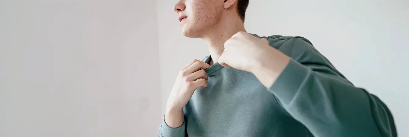 Points noirs persistants chez l’homme : pourquoi le peeling fait la différence